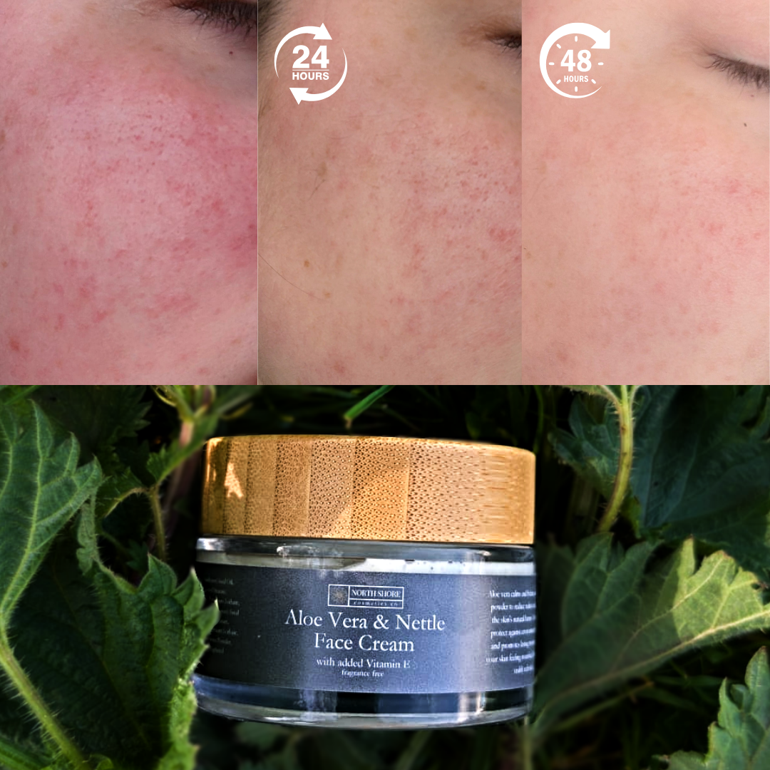 Anti-redness Aloe & Nettle Face Cream